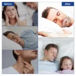 Anti-Snoring Mouth Tape – Improve Sleep & Stop Snoring (90 Pcs)